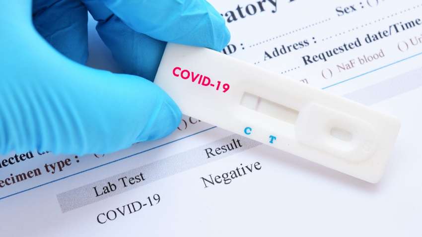Тест-системы для обнаружения COVID-19 – на сколько их хватит Украине