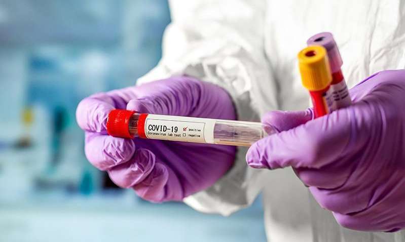 Ученые нашли дефекты мозга у умерших пациентов с COVID: о чем это говорит