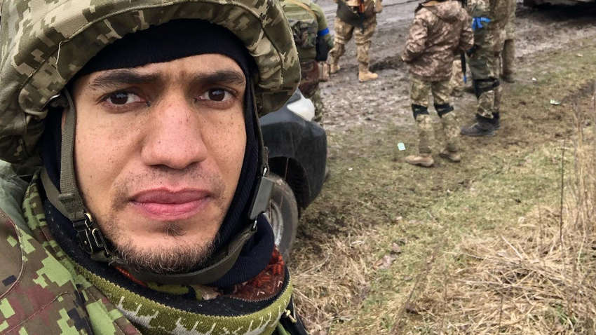 Український актор потрапив до госпіталю: отримав серйозне поранення, але переміг в бою з окупантами